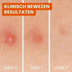 Reiniging<Bioré 3-in-1 Anti Spot Patches 24 stuks