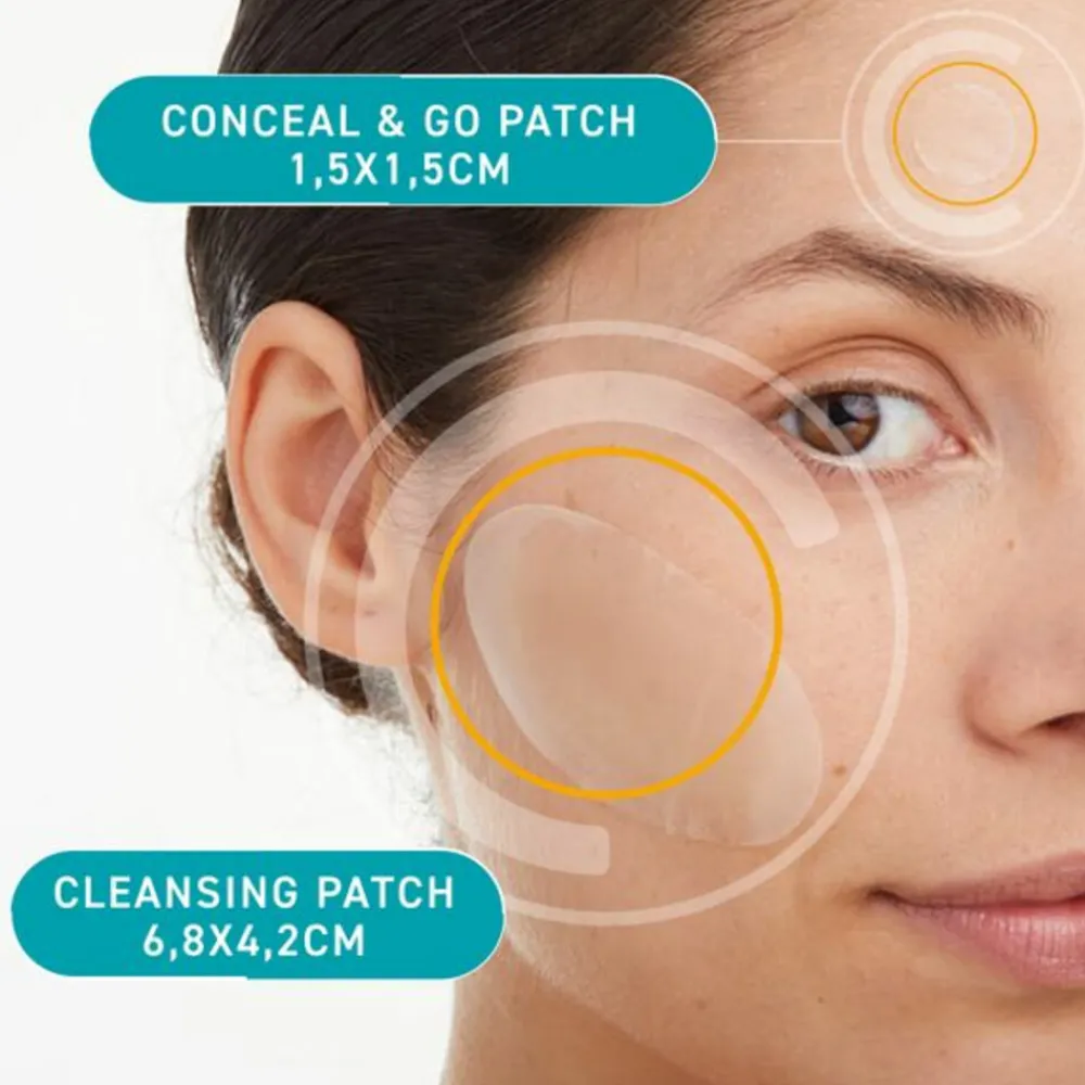 Sale Anti Spots med Medium 7 stuks Reiniging