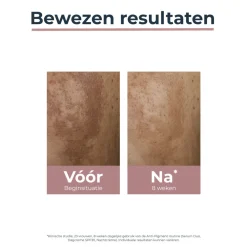 Gezicht<Eucerin Anti-Pigment Dagcrème SPF30 50 ml