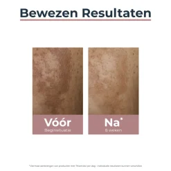 New Anti-Pigment Spot Corrector 5 ml Gezicht