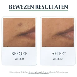 DermoPure Triple Action Serum 40 ml^Eucerin Outlet