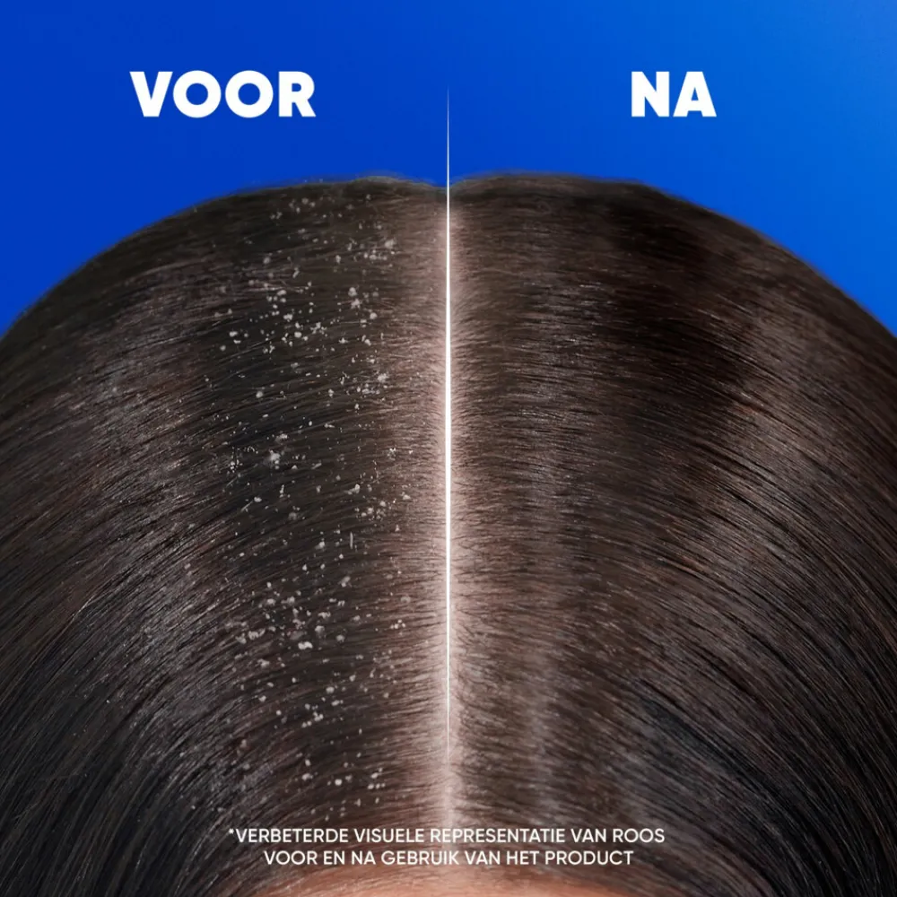 Shampoo<Head & Shoulders Shampoo Jeukende Hoofdhuid 300 ml