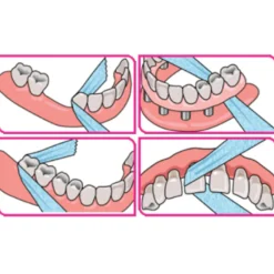 New X-Ribbon 12 meter Flossen & Ragen