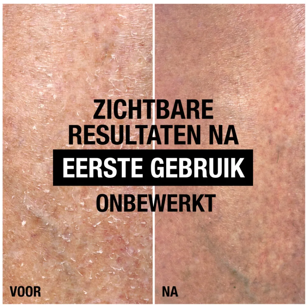 Intense Repair Cica Body Balm 250 ml^Neutrogena Outlet