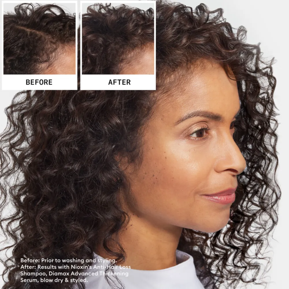 Anti-Hairloss Shampoo 475 ml^Nioxin