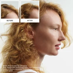 System 4 Loyalty Kit 3 stuks^Nioxin