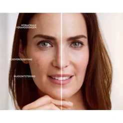 Luminous 630 Dagcrème Anti-Spot SPF 50 40 ml^NIVEA Discount