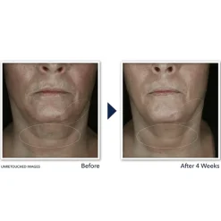 Dag- & Nachtcrème<RoC Derm Correxion Contour Cream 50 ml