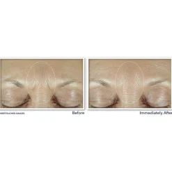 Serum<RoC Derm Correxion Fill+ Treat Serum 15 ml