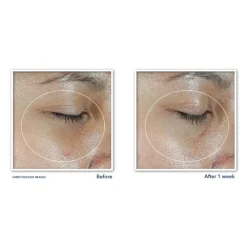 Multi Correxion Revive + Glow Eye Stick 4 gr^RoC Clearance