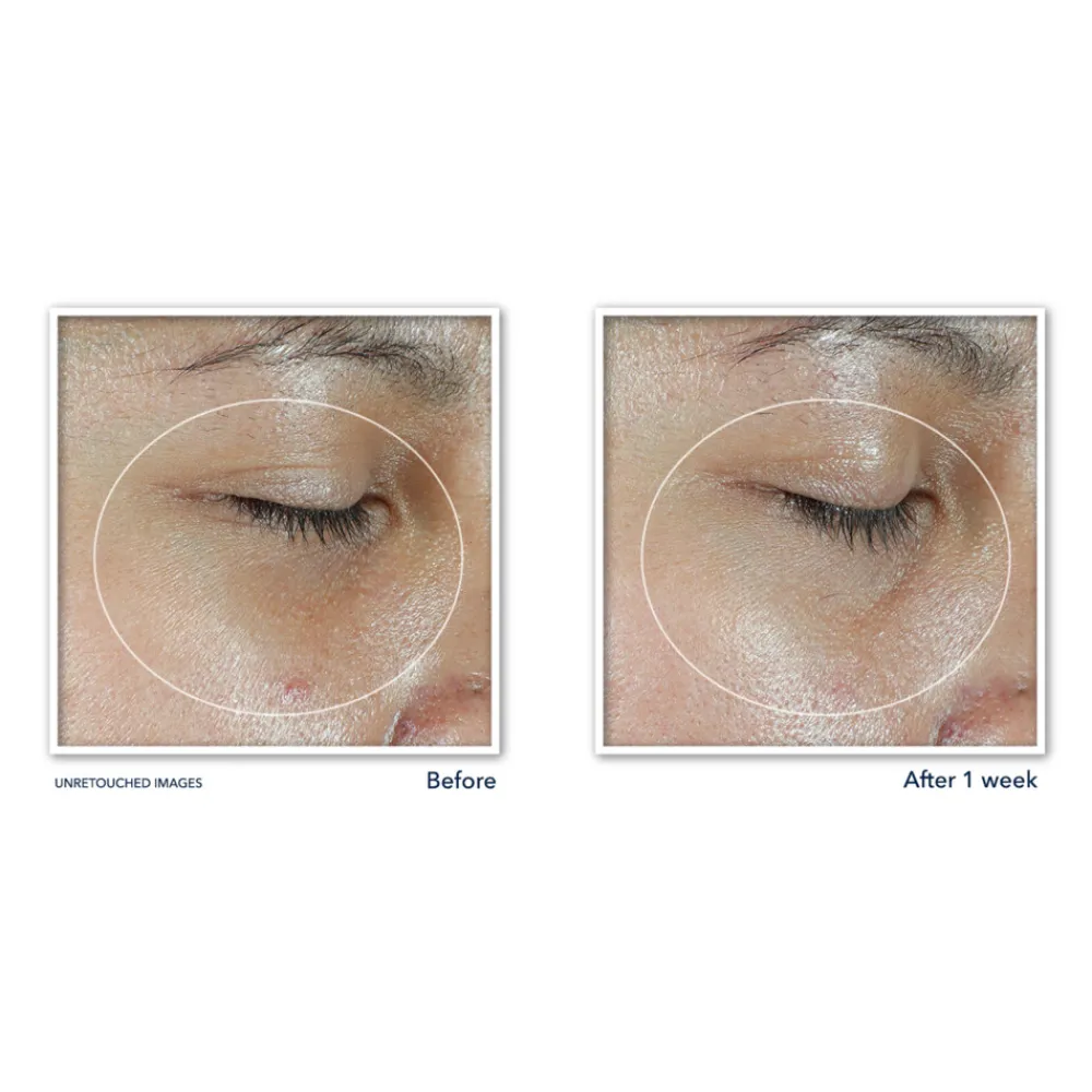 Multi Correxion Revive + Glow Eye Stick 4 gr^RoC Clearance