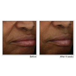 Dag- & Nachtcrème<RoC Multi Correxion Revive + Glow Gel Crème 50 ml