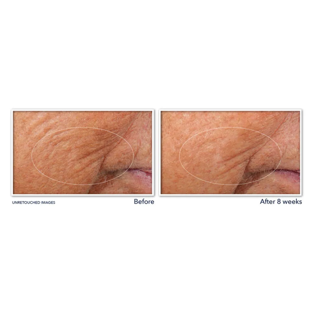 Retinol Correxion Serum Nacht 30 stuks^RoC