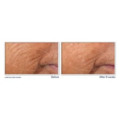 Retinol Correxion Serum Nacht 10 stuks^RoC Outlet