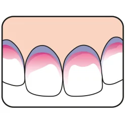 PlaqSearch 10 tabletten^TePe Discount