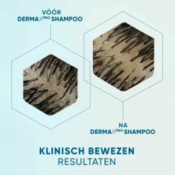 6x Anti-roos Shampoo DERMAxPRO Sensitive 250 ml Shampoo