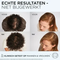 6x L'Oréal Elvive Fiber Booster Anti-Haaruitval Conditioner 150 ml Conditioner